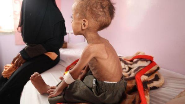 L'Unicef: "Lo Yemen è un inferno in terra per i bambini"