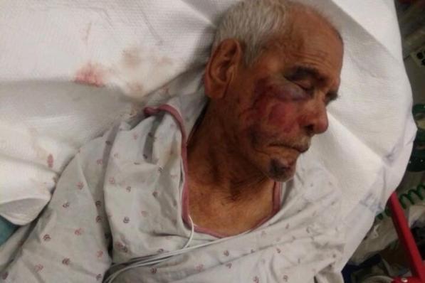 "Tornatene in Messico", 91enne preso a mattonate in California