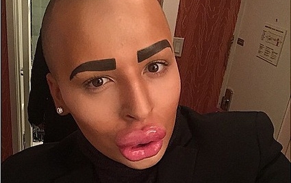 Spende 100mila sterline per somigliare a Kim Kardashian